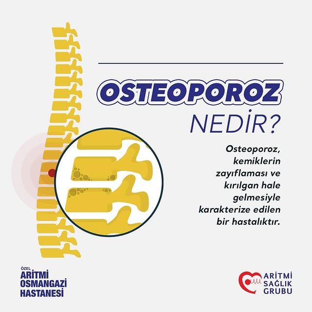 Osteoporoz: Sessiz Kemik Hastalığı